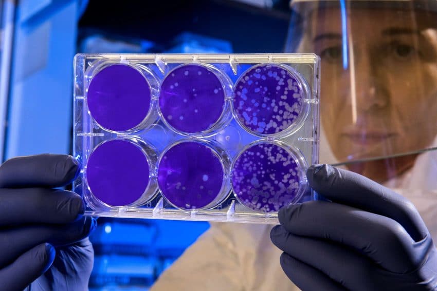 Public health scientist examines petri dish with gloves and face shield