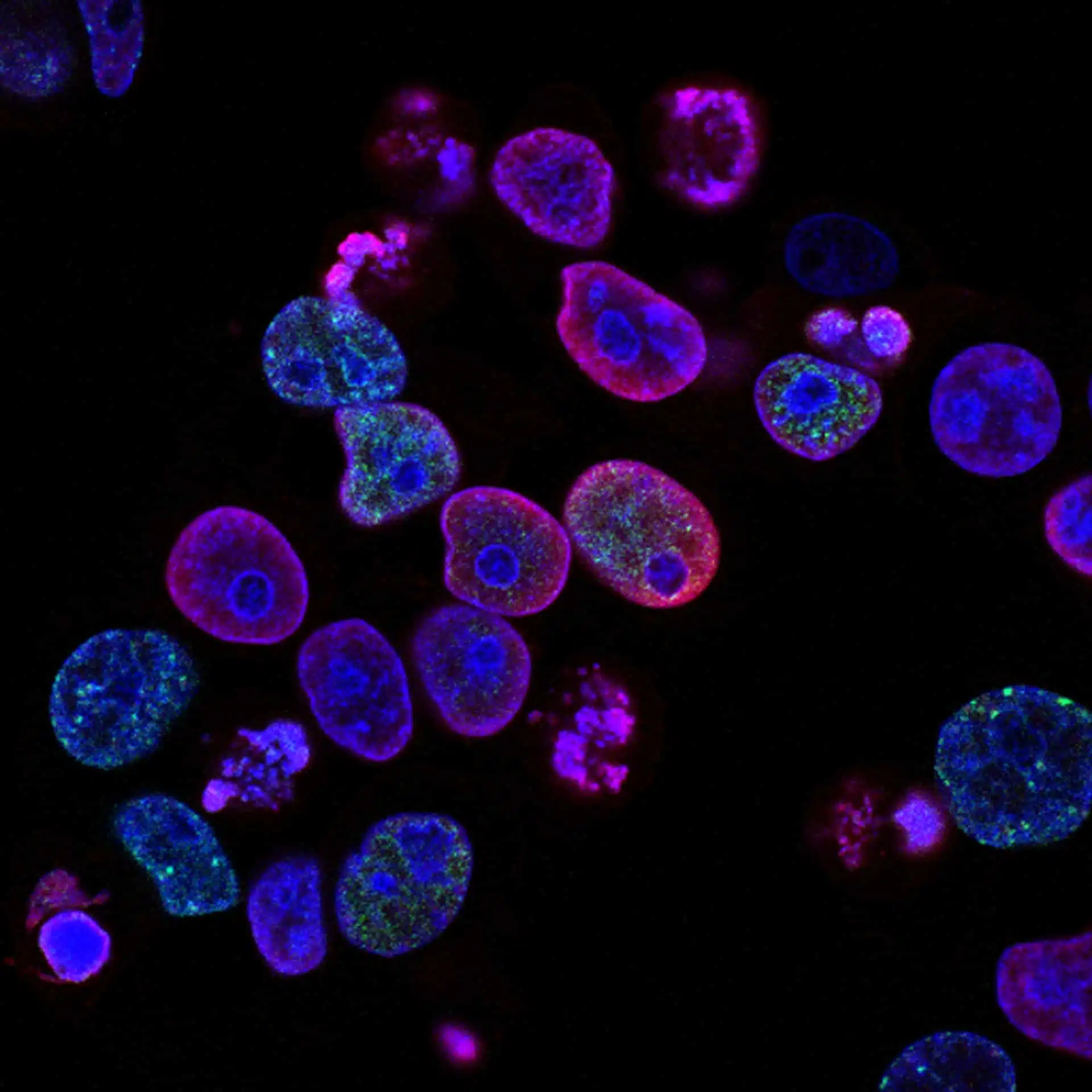 Photo of purple cells under a microscope
