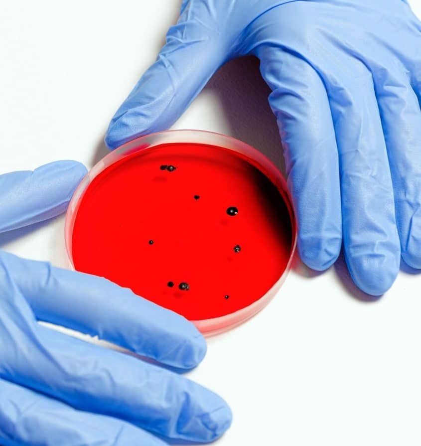 Person with gloves and petri dish